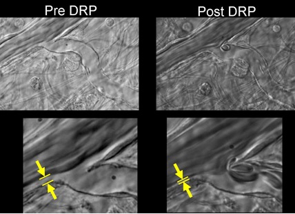 photomicrographs