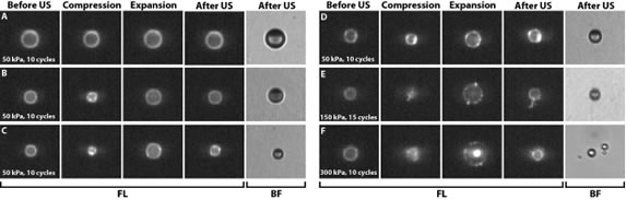 http://www.imagingtherapeutics.pitt.edu/about/technologies/images/clip_image008.jpg